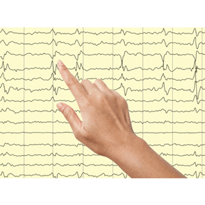 Learn Essentials of Adult Electroencephalography (EEG)
